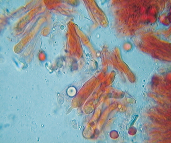 Tricholoma equestre vs. Tricholoma chrysophyllum